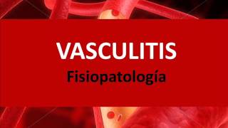 Vasculitis  Fisiopatología [upl. by Pan474]