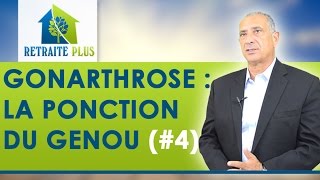 Gonarthrose  Ponction du genou  Conseils Retraite Plus [upl. by Maupin792]