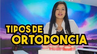 Tipos de BracketsOrtodoncia – Odontología Láser [upl. by Clapper714]