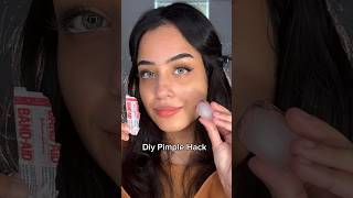 Diy pimple patch which literally reduce redness in just 20 minutes 😍 [upl. by Erdnael]