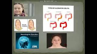 Causes epidemiology and risk factors of celiac disease Celiac disease lecture 4 [upl. by Persons]