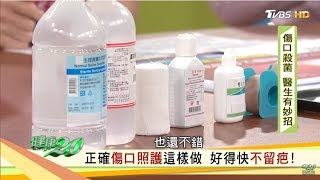 正確傷口照護這樣做，好得快不留疤！健康20 [upl. by Guilbert]