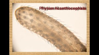 Phylum Acanthocephala quot Thornyheaded worms Dr Manar Elmehankar [upl. by Niwri867]