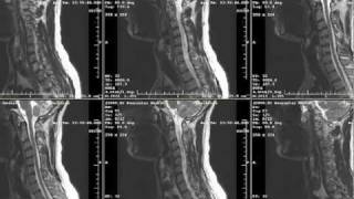 XRays CT Scans amp MRIs  What Are They [upl. by Ram]