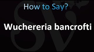 How to Pronounce Wuchereria bancrofti correctly [upl. by Alimak673]