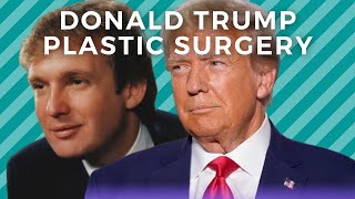 Donald Trumps ExWife Revealed His Plastic Surgery Secret [upl. by Ayot718]