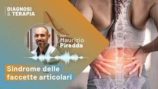 La sindrome delle faccette articolari  Dott Maurizio Piredda [upl. by Edecrem]