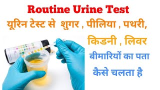 urine routine test explain in Hindi  urine test normal range [upl. by Cirri71]