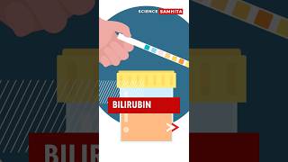 The Role of Bilirubin in Your Body bilirubin [upl. by Philly]