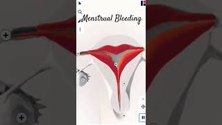 MENSTRUAL BLEEDING IN 3d menstruation shorts menstrualcycle short viral mc dr shortvideo [upl. by Hayotal]