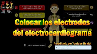 Electrocardiograma interpretación  ¿Cómo y dónde colocar los electrodos del electrocardiograma [upl. by Sean]