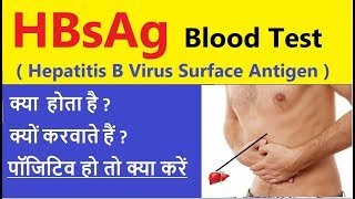 HbsAg test in hindi  HBsAg टेस्ट पॉजिटिव हो तो क्या करें  HbsAg test क्या होता है I क्यों कराते है [upl. by Renny]