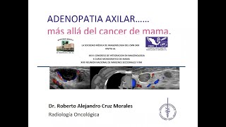 2  12 Adenopatía axilar más allá del cáncer de mama  Dr Cruz [upl. by Delmore580]