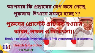 Benign prostatic hyperplasia symptoms and treatment bph প্রোস্টেট বড় হওয়ার লক্ষন ও চিকিৎসা BPH [upl. by Mannuela]