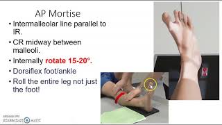 Foot toes calcaneus amp ankle xray protocol [upl. by Mendes]