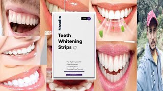 Masofta Teeth Whitening Strips  Honest Review [upl. by Feodora11]