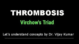 Thrombosis Pathology  Virchows Triad  Thrombus Formation  Pathology Lectures [upl. by Illib]