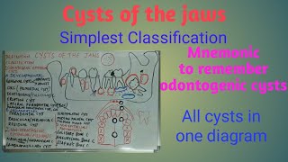 Cysts of the jaws  definition classification origin and location [upl. by Renita]