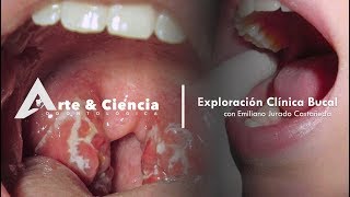 ►Exploración Clínica Bucal  Dr Emiliano Jurado Castañeda [upl. by Pietra]