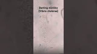 Darting motility  V cholerae Hanging Drop preparation microbiology infection neetpg medicine [upl. by Cori]