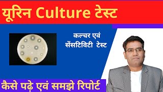 Urine culture test in Hindi I Culture and Sensitivity amp Test Result Interpretation Explained [upl. by Eicram929]