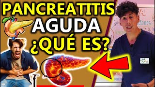 QUÉ ES PANCREATITIS AGUDA CAUSAS  GuiaMed [upl. by Whiffen]