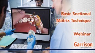 Basic Sectional Matrix Technique [upl. by Sirovat]