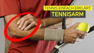 Was ist eigentlich ein Tennisarm  Tennis einfach erklärt [upl. by Brey]