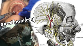 Dental Anesthesiology  Armamentarium amp Blocking Techniques 🦷💉 [upl. by Ennylhsa238]