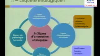 Conduite à Tenir devant une Ascite Abdominale Cas Clinique physiopathologie Symptomes [upl. by Bohs]