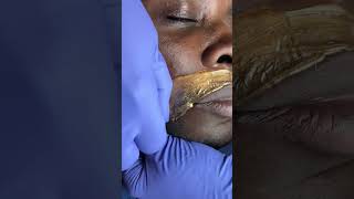 Male beard waxing service performed by esthetician using hard wax from Honeycomb Wax co [upl. by Hgieloj]