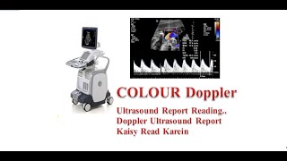 Doppler Ultrasound Report Reading In Urdu  Hindi [upl. by Oby]