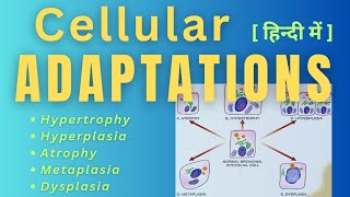 cellular ADAPTATION 》 in hindi 》 basic pathology for mbbs cellularadaptationpathology [upl. by Busch]