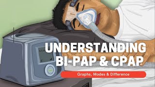 Uncovering The Secret of BIPAP vs CPAP  Dive Into Modes amp Graphs NOW [upl. by Shelba5]