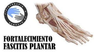 Fascitis plantar ejercicios de fortalecimiento [upl. by Khai212]