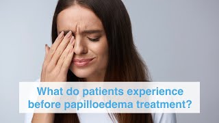 What do patients experience before papilloedema treatment [upl. by Hafinah]