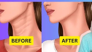 Easy exercise to get rid of from neck line neck lines treatment exercise to finish necklines [upl. by Eelarak]