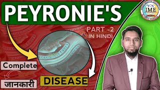 All About Peyronies Disease Homoeopathic medicine for Peyronies diseasepeyroniesdisease [upl. by Eisso]