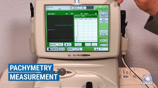 NIDEK US4000500 Ultrasound  Pachymetry Overview [upl. by Colby]