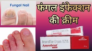 Amrobrut cream  Benefits Side effects Price How it works in body  Nail infection  Athlete foot [upl. by Aoket]