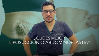 Liposucción vs Abdominonoplastia Lipoescultura o Lipectomia ¿Cuál es mejor [upl. by Herwick466]