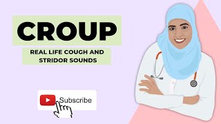 CHILDRENS DOCTOR EXPLAINS CROUP REAL LIFE EXAMPLES of COUGH AND STRIDOR [upl. by Oiratno163]