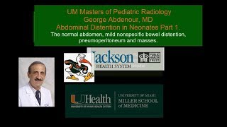 Abdominal Distention in Neonates Part 1 and 2 Masters of Pediatric Radiology [upl. by Albertina887]