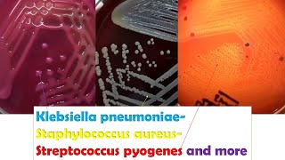 Klebsiella Streptococcus and Staphylococcus Colony Morphology Demonstration [upl. by Crifasi]