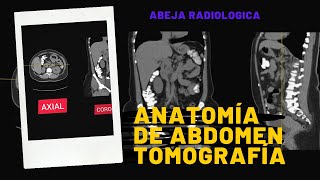 ANATOMIA DE ABDOMEN POR TOMOGRAFIA [upl. by Nyraf]