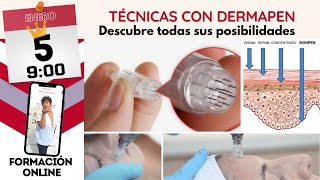 Técnicas con Dermapen ¿Cuándo utilizo el dermapen [upl. by Schechter969]