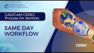 Same Day Workflow CADCAM CEREC Process for dentists [upl. by Marni]