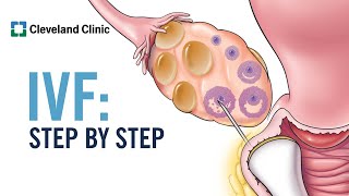 How Does In Vitro Fertilization IVF Work A StepbyStep Explanation [upl. by Havstad]