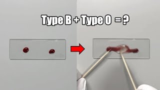 What Happens When Two Different Blood Types are Mixed Together [upl. by Hillel]