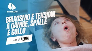 Bruxismo e tensioni a gambe spalle e collo il trattamento Chiropratico di Alina [upl. by Redna]